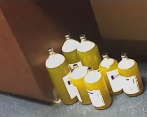 2ascites fluid