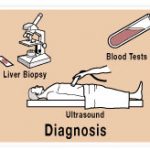 cirrhosis