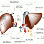 donor transplant