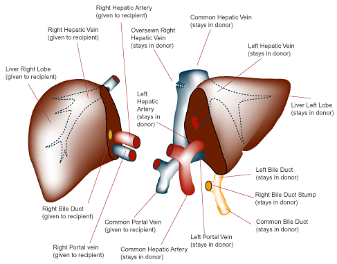 donor transplant