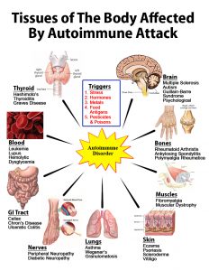 autoimmune