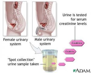 creatinine