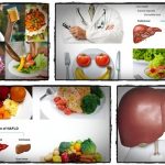 fatty liver diet