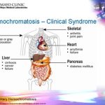 hemochromatosis