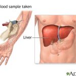 liver fuction tests