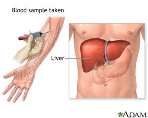 liver fuction tests