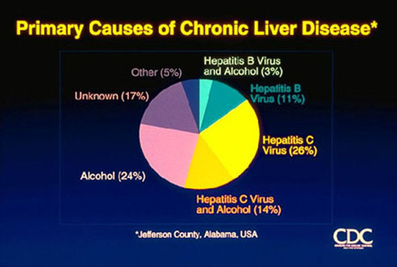 liver failure