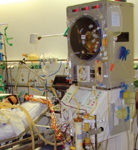 liver dialysis
