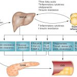 nafld