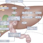 nafld