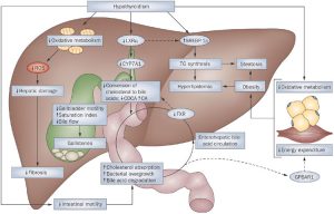 nafld