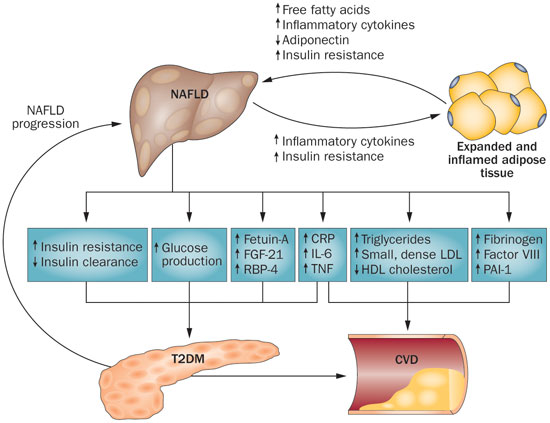 nafld