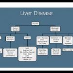 liver disease primer