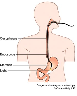 endoscopy