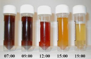 urine