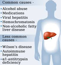 liver enzymes