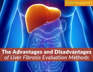 liver fibrosis